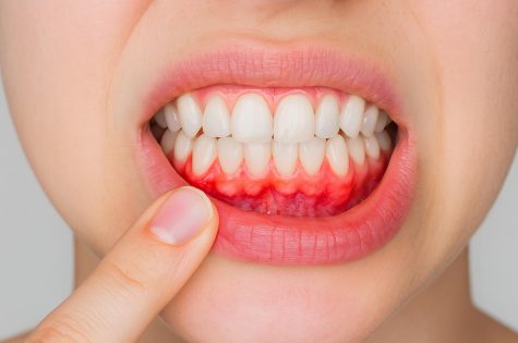 periodoncia